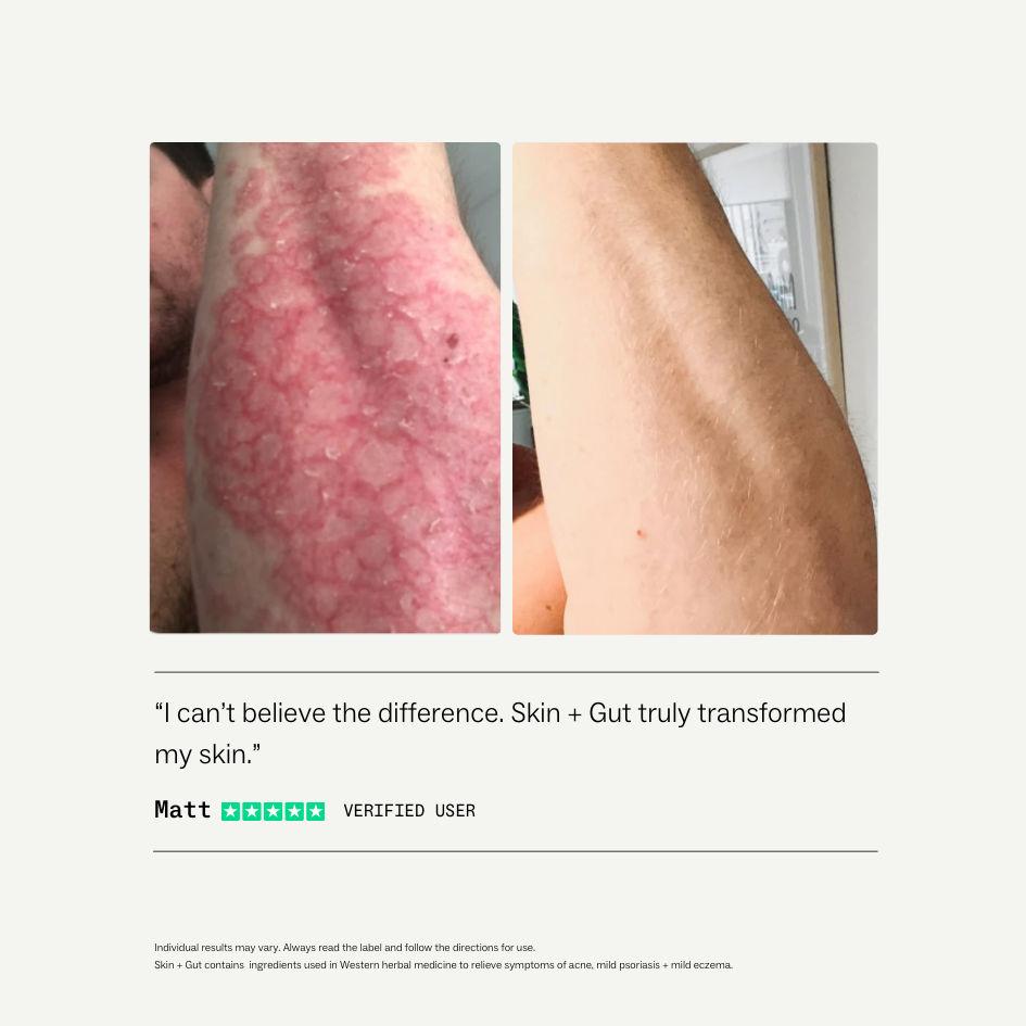 Skin + Gut®