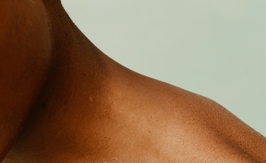 Steroid creams will never fix your psoriasis. Healing your gut might.