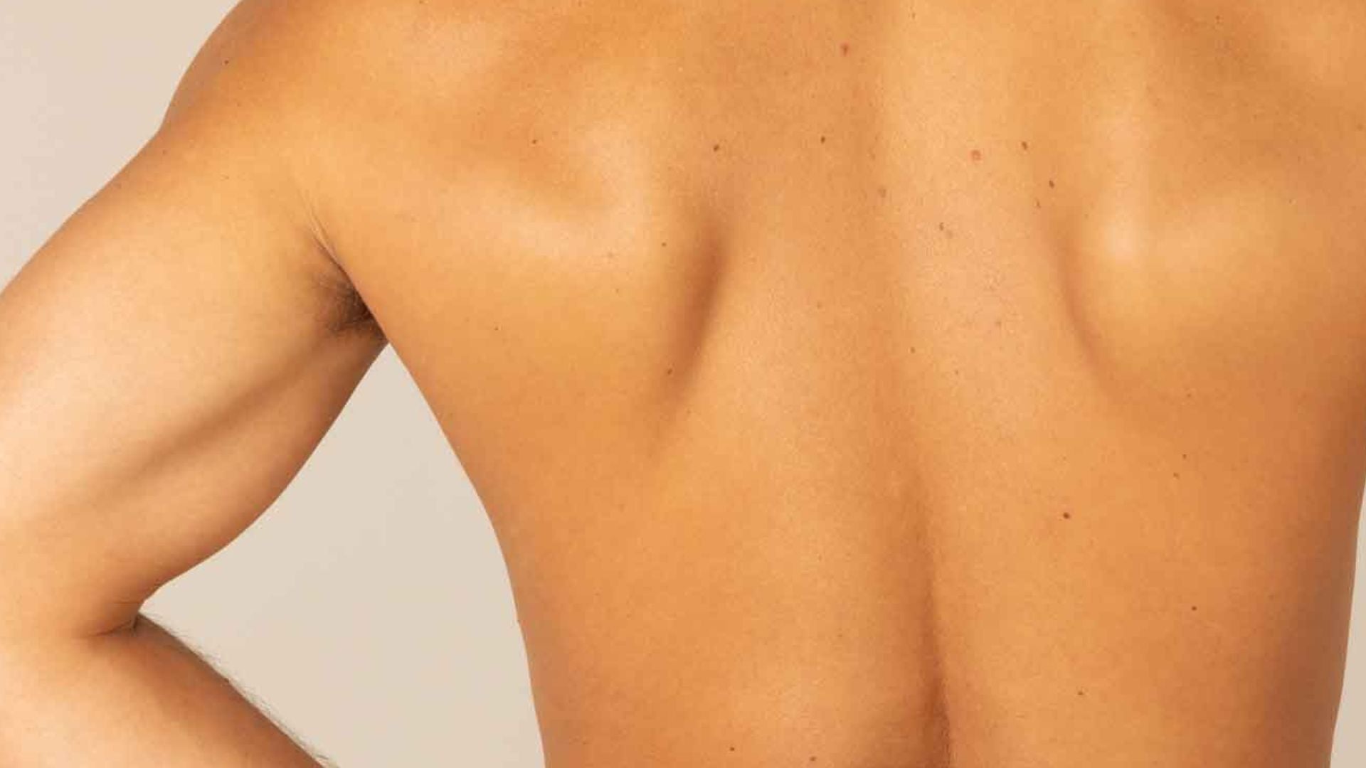 How to Improve Eczema + Psoriasis in 2025 | Top 5 Supplements