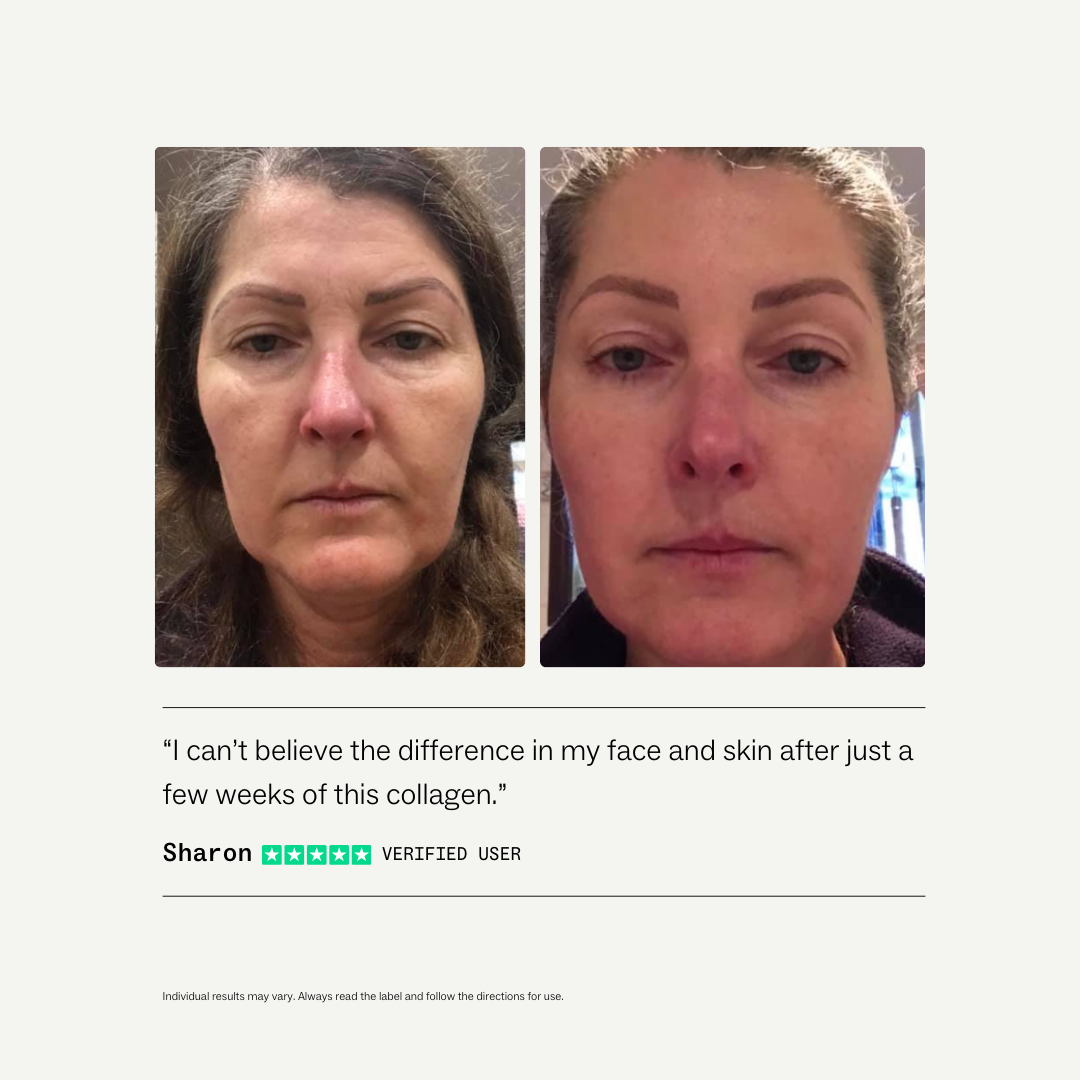 Collagen Restore™